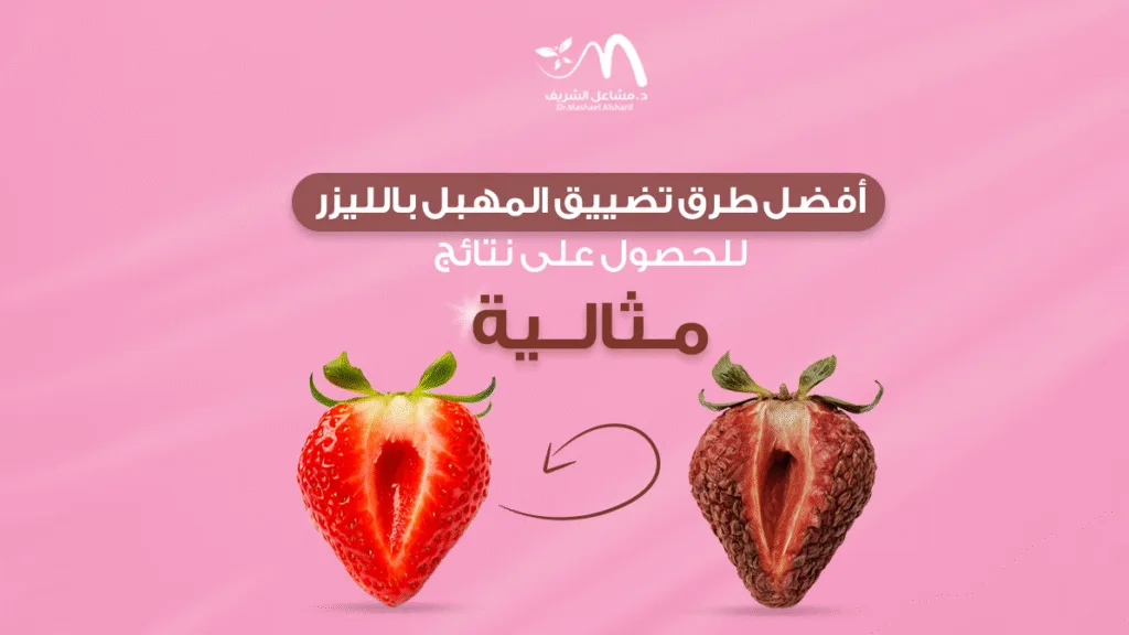 أفضل طرق تضييق المهبل بالليزر للحصول على نتائج مثالية