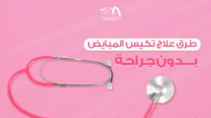 طرق علاج تكيس المبايض بدون جراحة