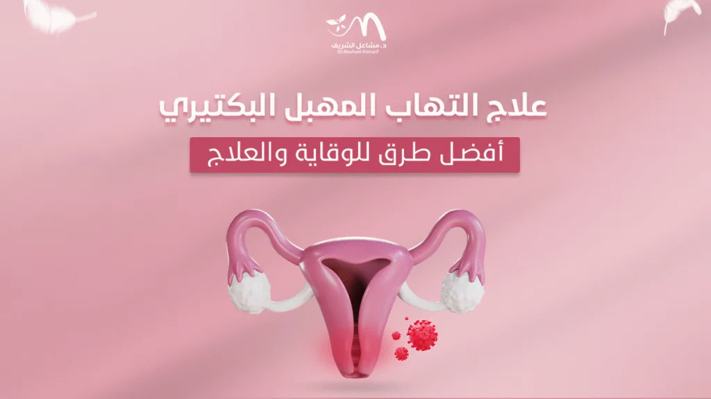 علاج التهاب المهبل البكتيري: أفضل طرق للوقاية والعلاج