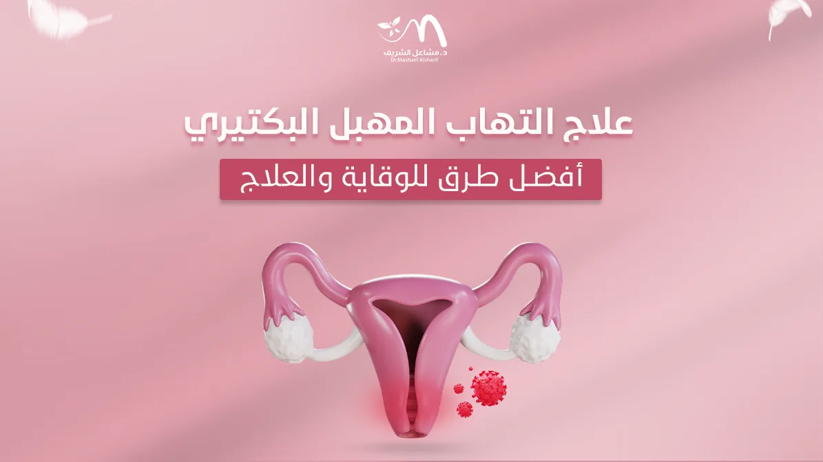 علاج التهاب المهبل البكتيري: أفضل طرق للوقاية والعلاج