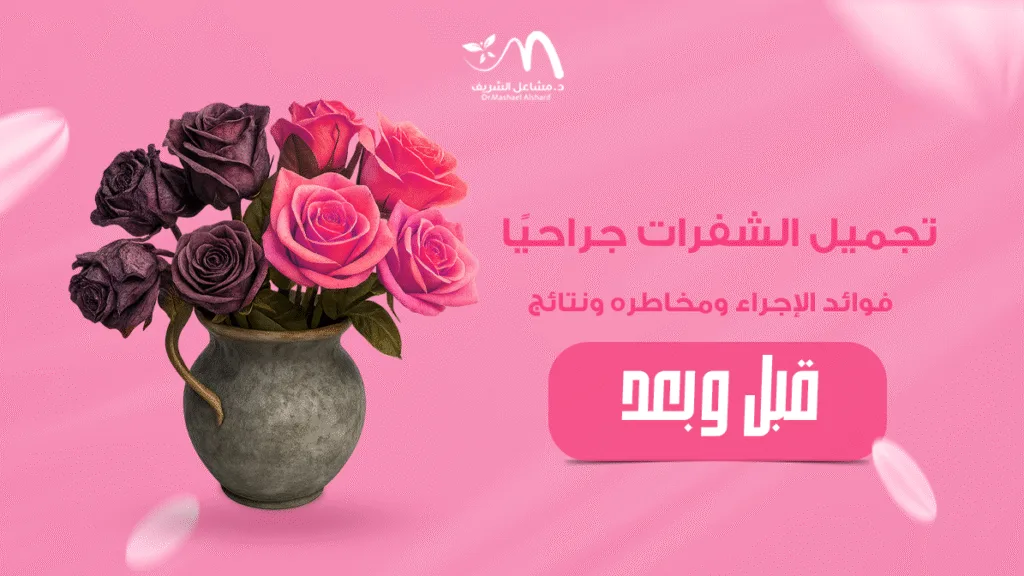 تجميل الشفرات جراحيًا: فوائد الإجراء ومخاطره ونتائج قبل وبعد