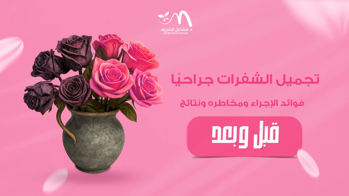 تجميل الشفرات جراحيًا: فوائد الإجراء ومخاطره ونتائج قبل وبعد