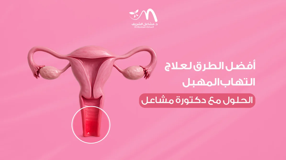 أفضل الطرق لعلاج التهاب المهبل: الحلول مع دكتورة مشاعل