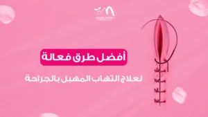 أفضل طرق فعالة لعلاج التهاب المهبل بالجراحة