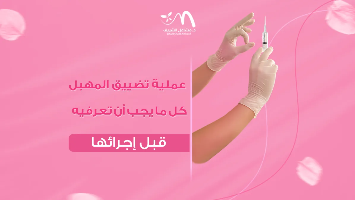 عملية تضييق المهبل كل ما يجب أن تعرفيه قبل إجرائها
