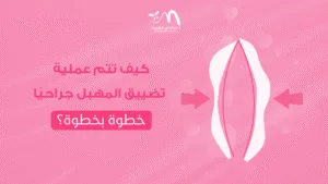 كيف تتم عملية تضييق المهبل جراحيًا خطوة بخطوة؟