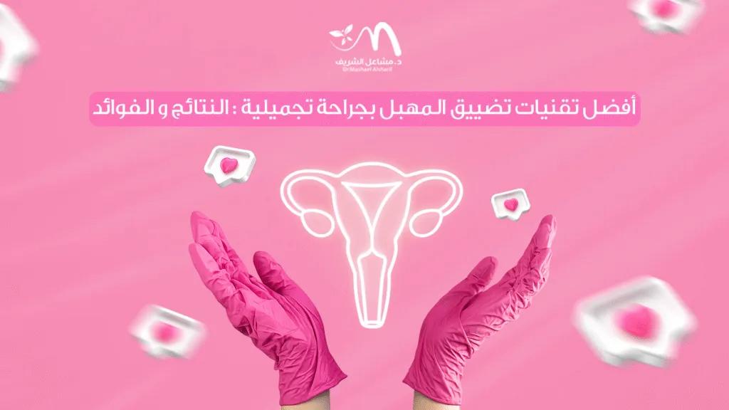 أفضل تقنيات تضييق المهبل بجراحة تجميلية: النتائج والفوائد