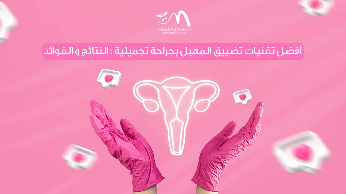 أفضل تقنيات تضييق المهبل بجراحة تجميلية: النتائج والفوائد