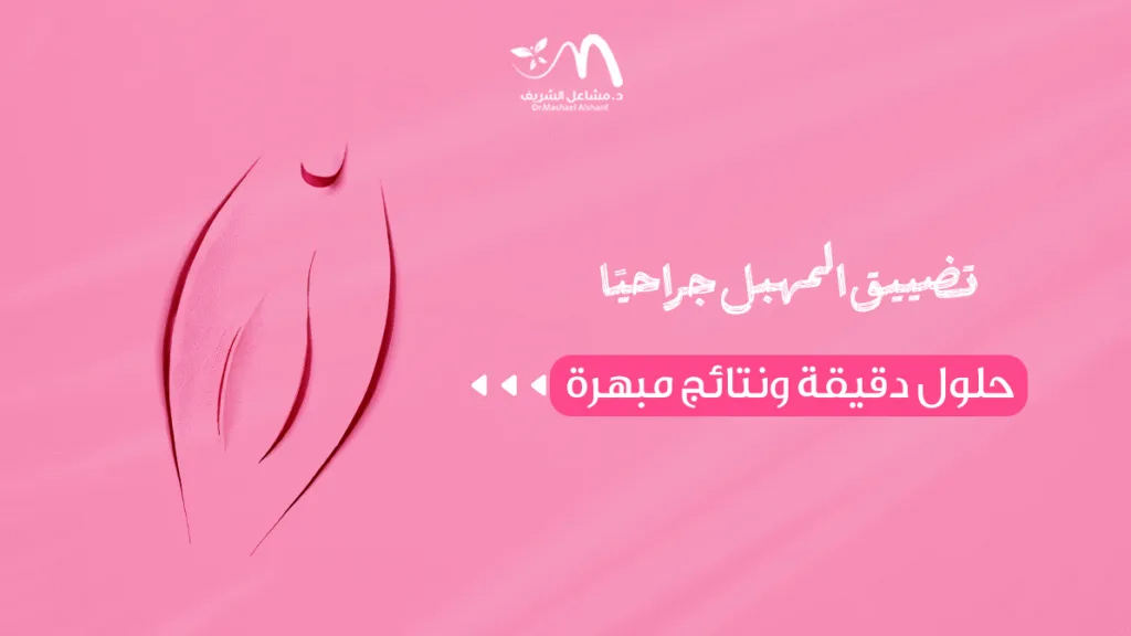 تضييق المهبل جراحيًا: حلول دقيقة ونتائج مبهرة