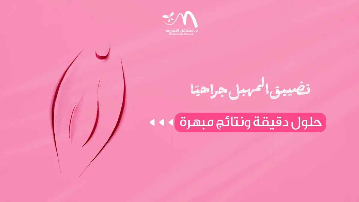 تضييق المهبل جراحيًا: حلول دقيقة ونتائج مبهرة