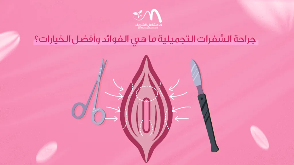 جراحة الشفرات التجميلية: ما هي الفوائد وأفضل الخيارات؟