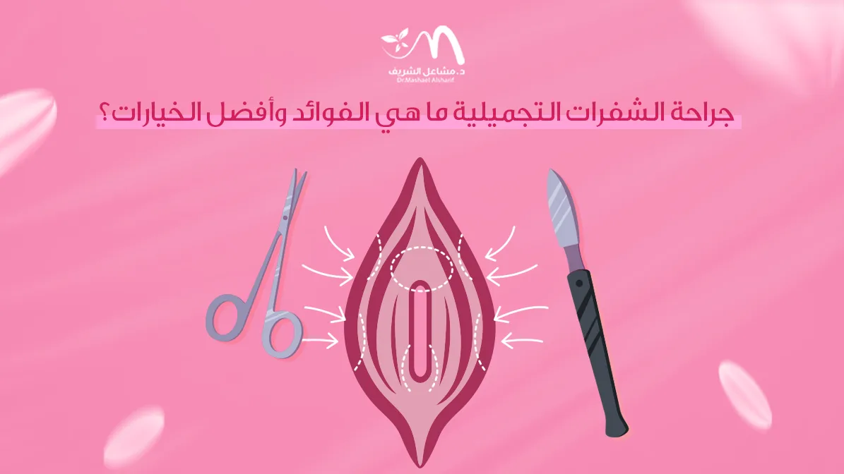 جراحة الشفرات التجميلية: ما هي الفوائد وأفضل الخيارات؟