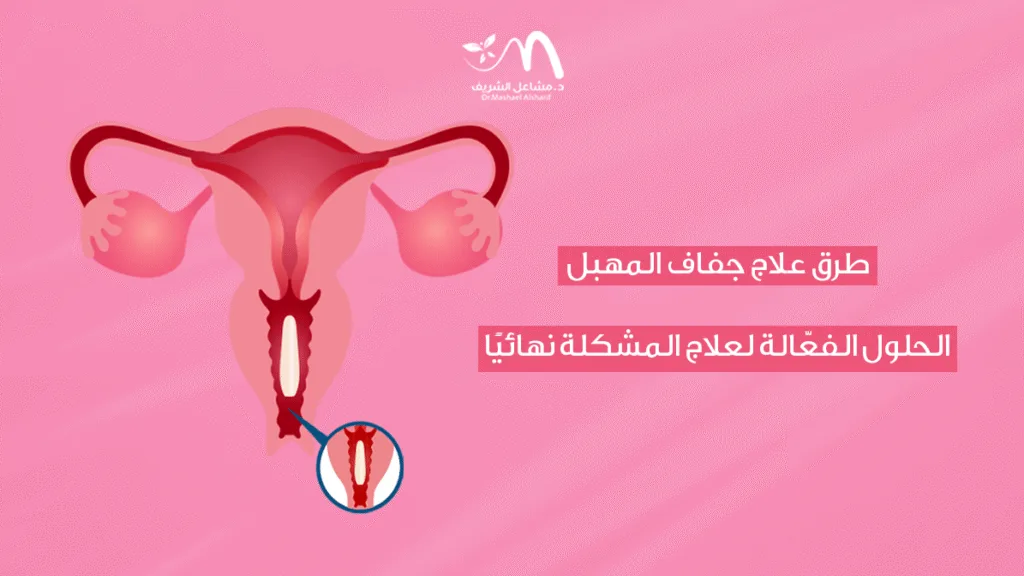 طرق علاج جفاف المهبل: الحلول الفعّالة لعلاج المشكلة نهائيًا