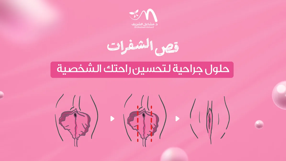 قص الشفرات: حلول جراحية لتحسين راحتك الشخصية