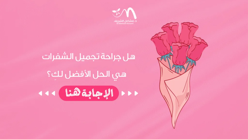 هل جراحة تجميل الشفرات هي الحل الأفضل لكِ؟ الإجابة هنا