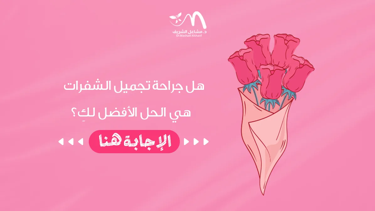 هل جراحة تجميل الشفرات هي الحل الأفضل لكِ؟ الإجابة هنا